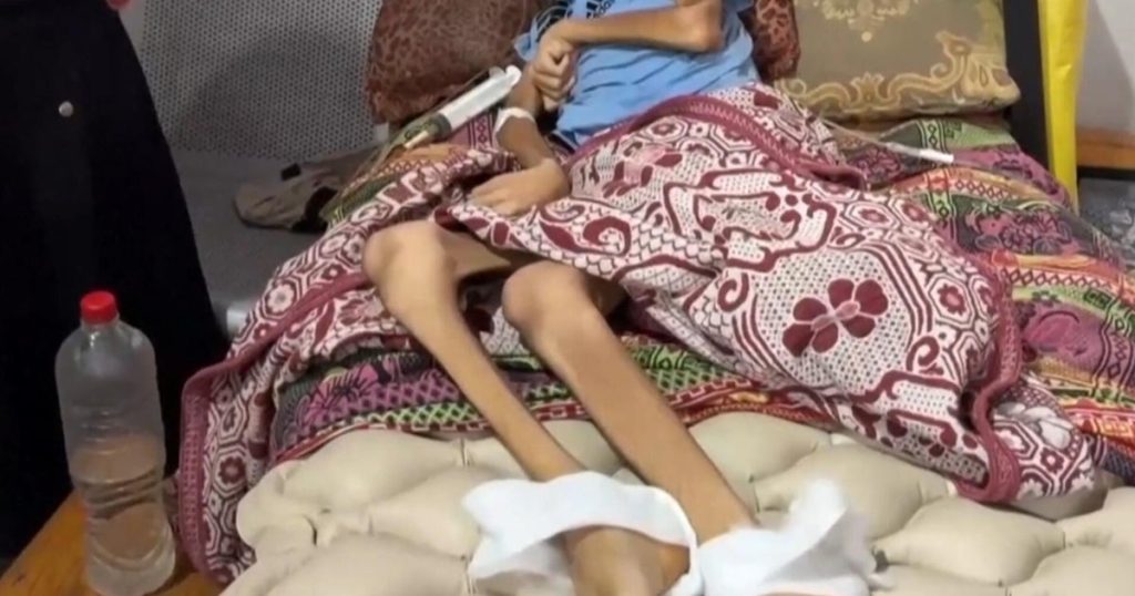 cbsn-fusion-disturbing-images-starvation-gaza-thumbnail.jpg