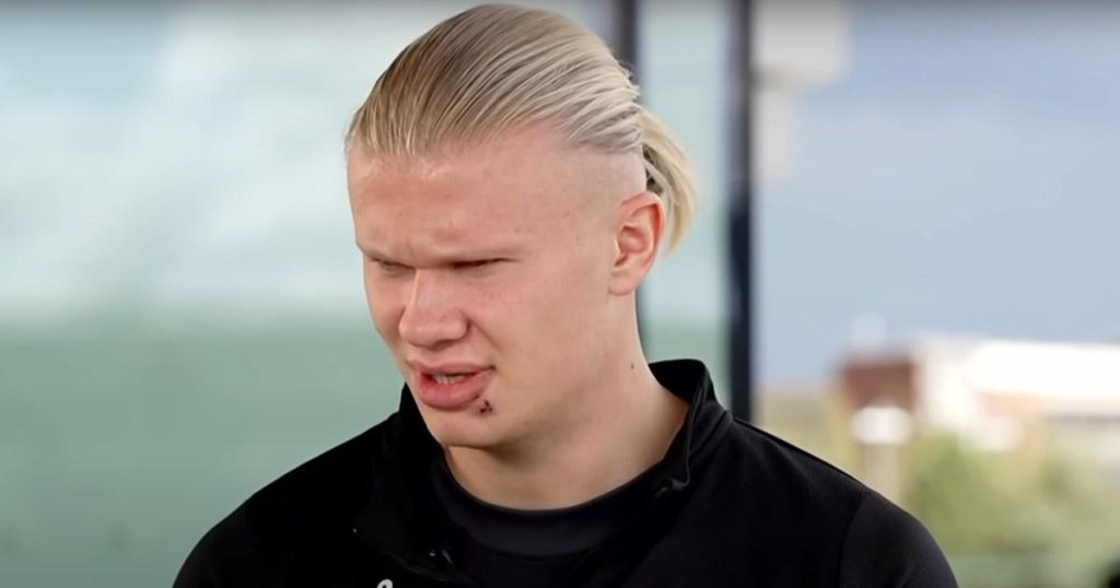Erling-Haaland-lip-injury-54de_1757771452.jpg
