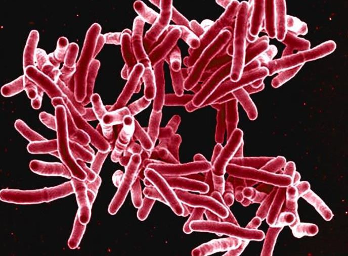 Thiomargarita-bacteria.jpg